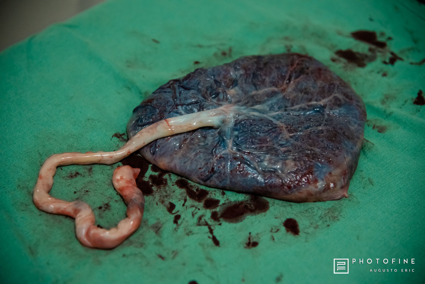 A IMPORTÂNCIA DA PLACENTA!